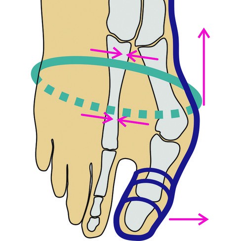 Hallux-sokken van bio-katoen, zwart from Waschbär