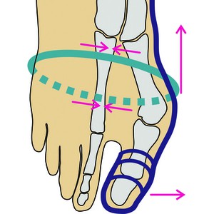 Hallux-sokken van bio-katoen, zwart from Waschbär